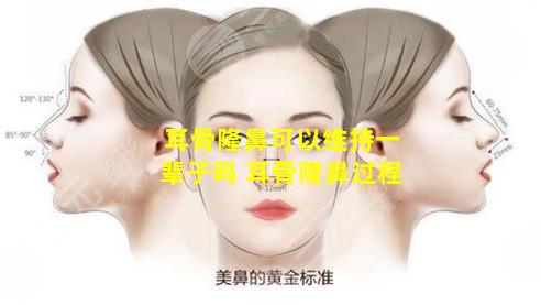 耳骨隆鼻可以维持一辈子吗 耳骨隆鼻过程